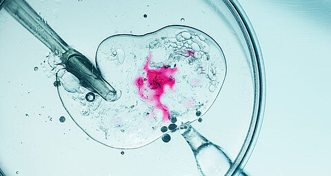 Eine Petrischale mit einer Flüssigkeit, die eine rosarote Substanz enthält, umgeben von Blasen und einer Pipette.