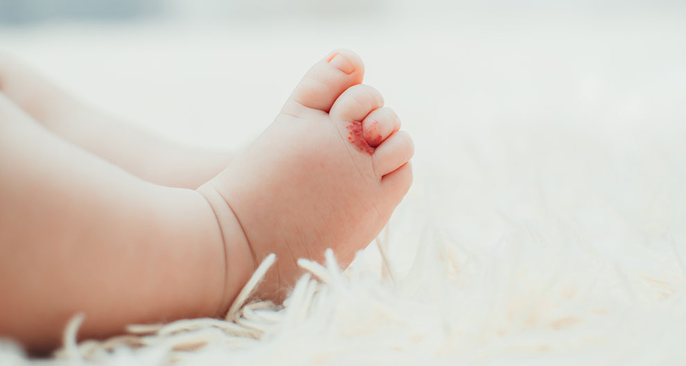 Ein Babyfuß mit einem roten Fleck auf einer weißen, flauschigen Oberfläche.